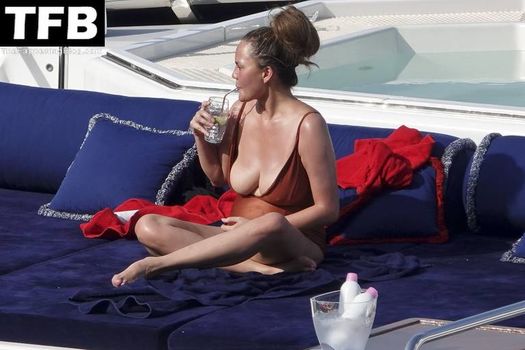Chrissy Teigen